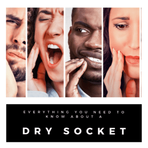 Everything You Need to Know About a Dry Socket