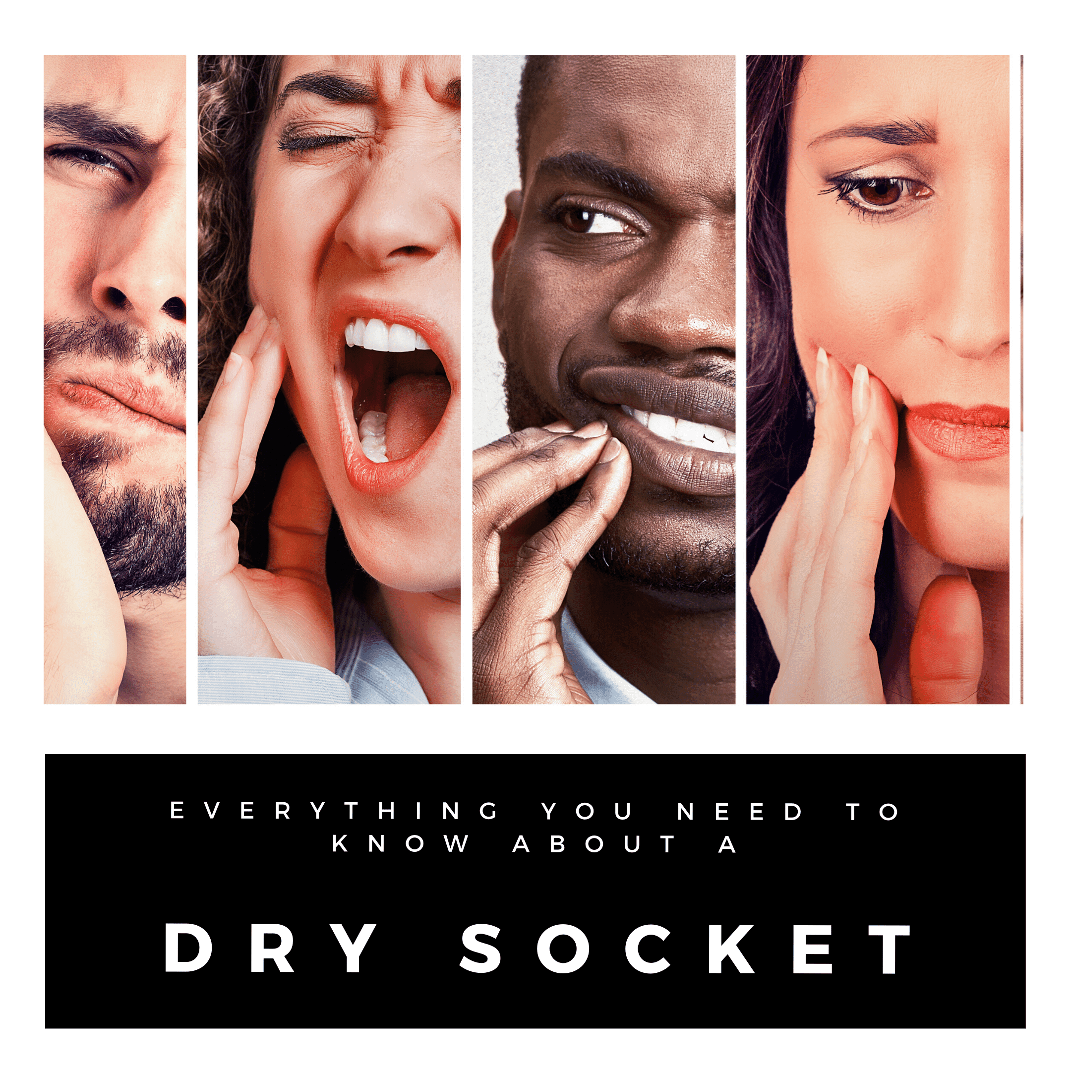 A Dry Socket - What is it, why does it happen, and how is it