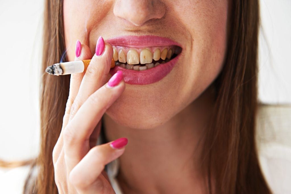 woman with stained teeth smoking a cigarette