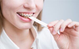 Woman Chewing With Braces